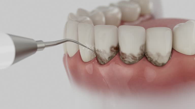 Trusted Teeth Cleaning And Checkup service in Carrollton, TX - Dentist Open Now